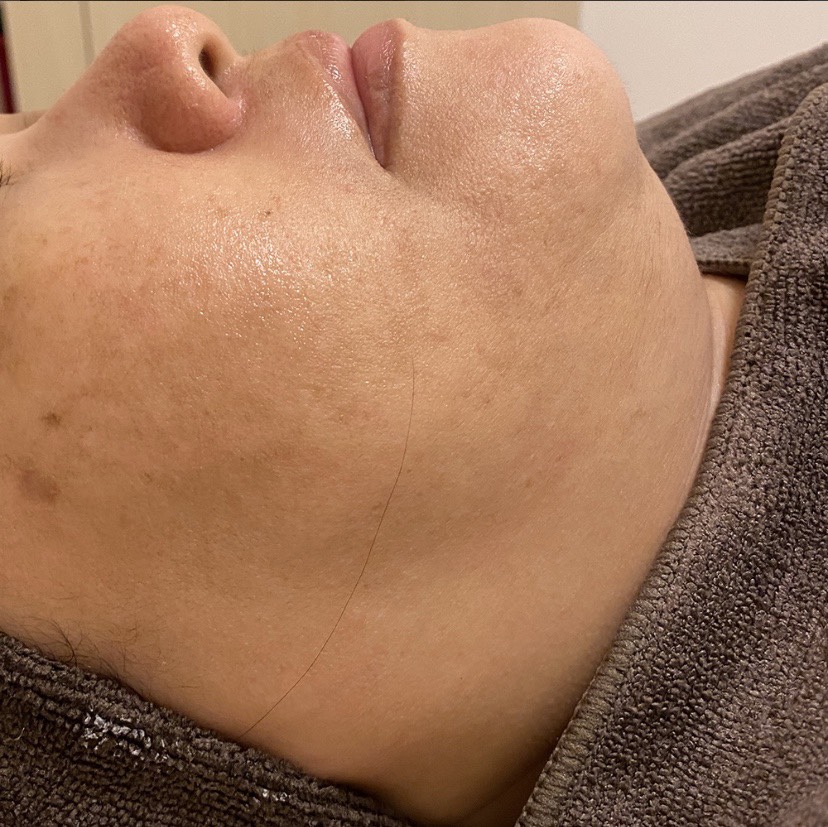 ENVIRON​スペシャルフルコースの施術後